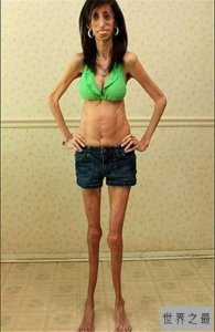 ​世界最丑女人，因演讲走红获30万粉丝！！！