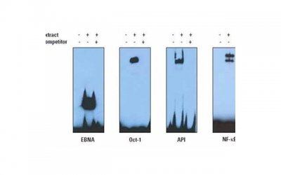 ​假如老婆出轨还会碰自己的老婆吗，老婆出轨后，还会再次爱抚自己的老婆吗