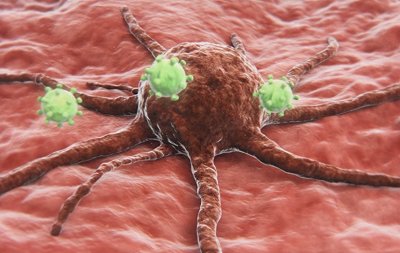 ​中国奇迹！我国新药打破欧美垄断，可有效杀死癌细胞！