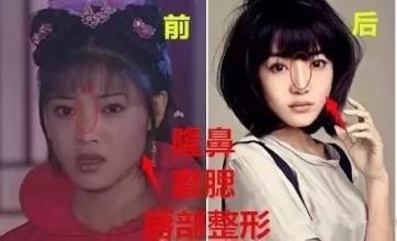 《爱情公寓》里的唐悠悠，原来整容前竟长这样